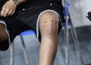 开云下载-包含瓦伦西亚中场膝盖受伤需手术的词条